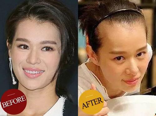 女明星有没有脱发的,美丽背后的健康挑战